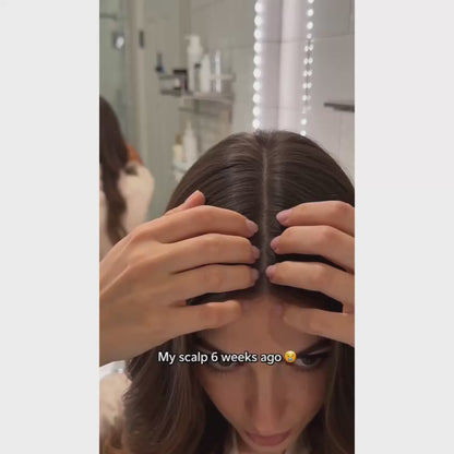 DreamRoot Red Light Scalp Massager for Hair Growth